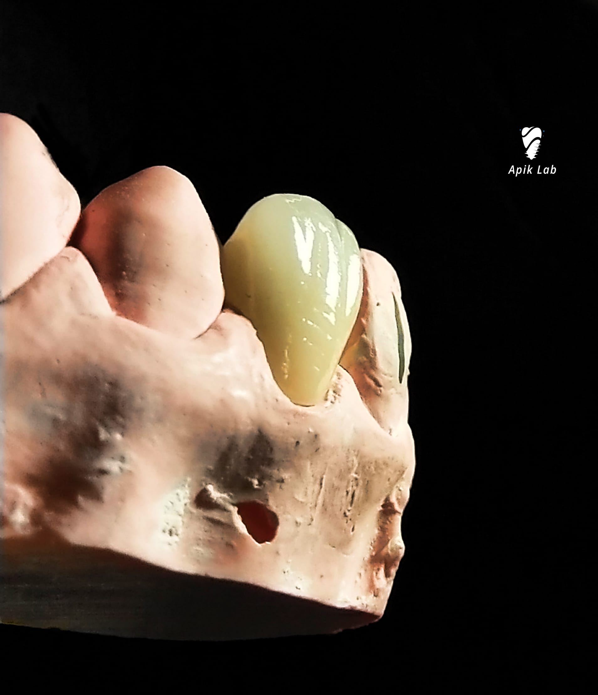Oentoe apik dental laboratory lab gigi indonesia jakarta bekasi