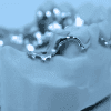 Metal RPD - Denture Kerangka Logam