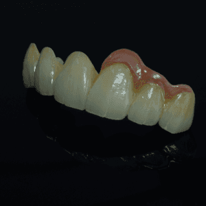 Zirconia Layer - PFZ