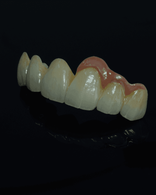 Zirconia Layer - PFZ