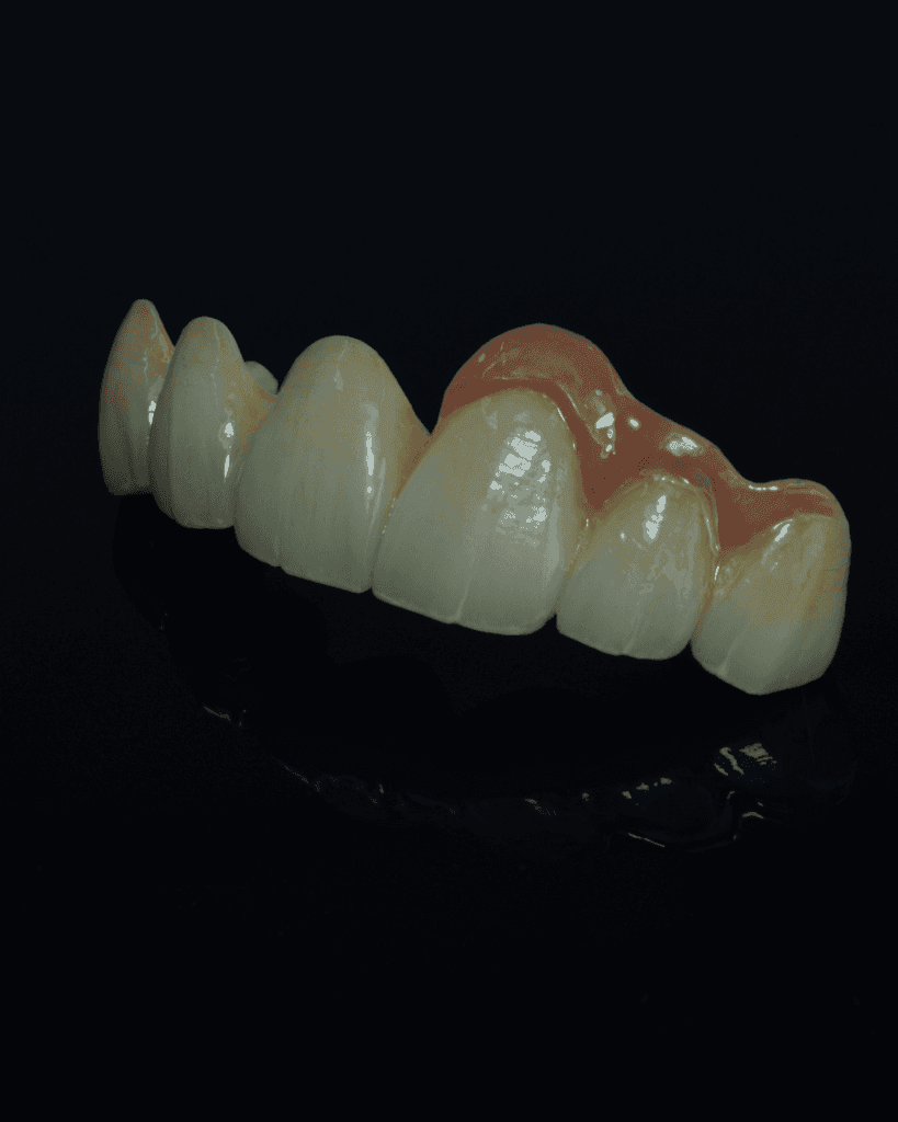 Zirconia Layer - PFZ