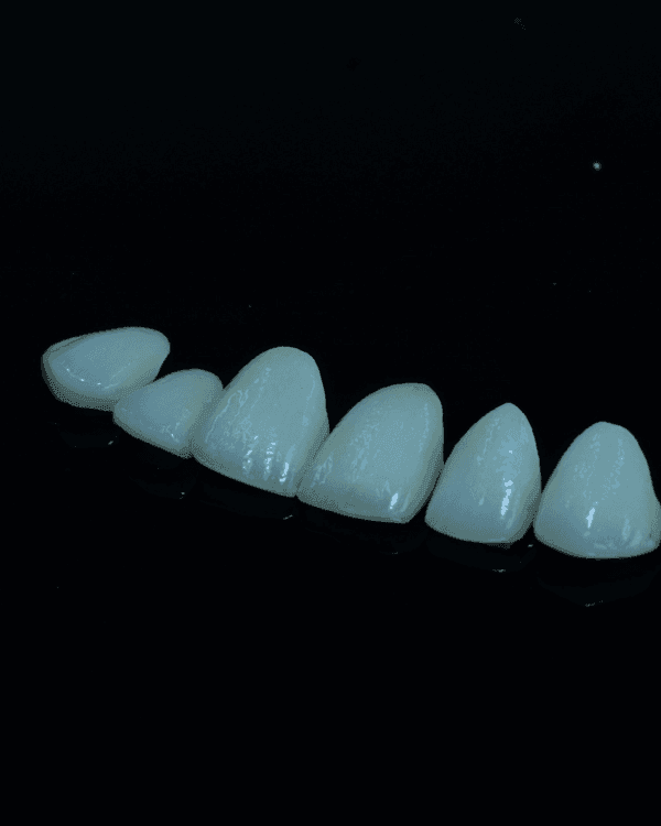 Lithium Disilicate