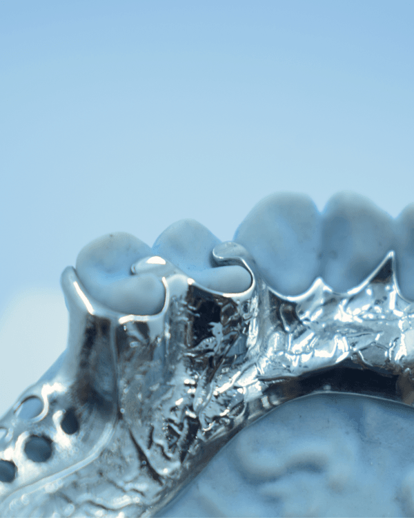 Metal RPD - Denture Kerangka Logam