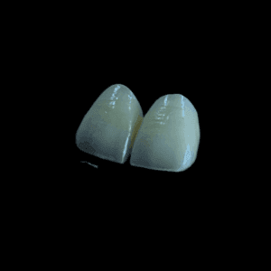 Ceramage - Ceramic Hybrid