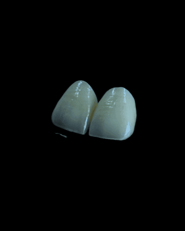Ceramage - Ceramic Hybrid