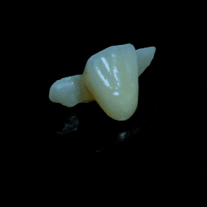 Temporary Restoration Series