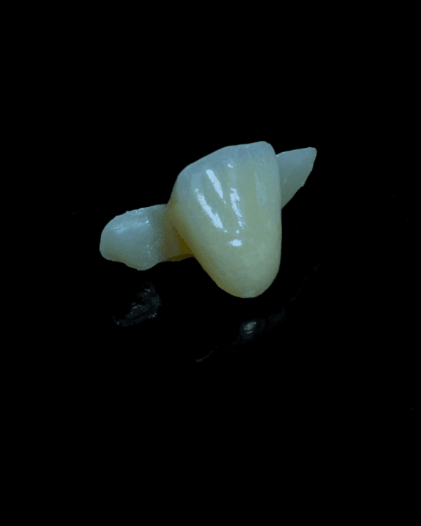 Temporary Restoration Series