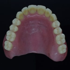 Acrylic Denture