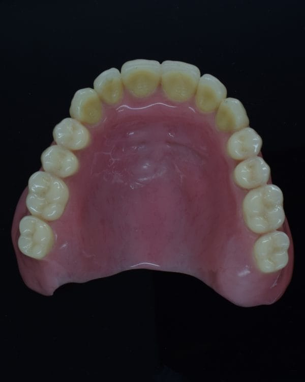 Acrylic Denture
