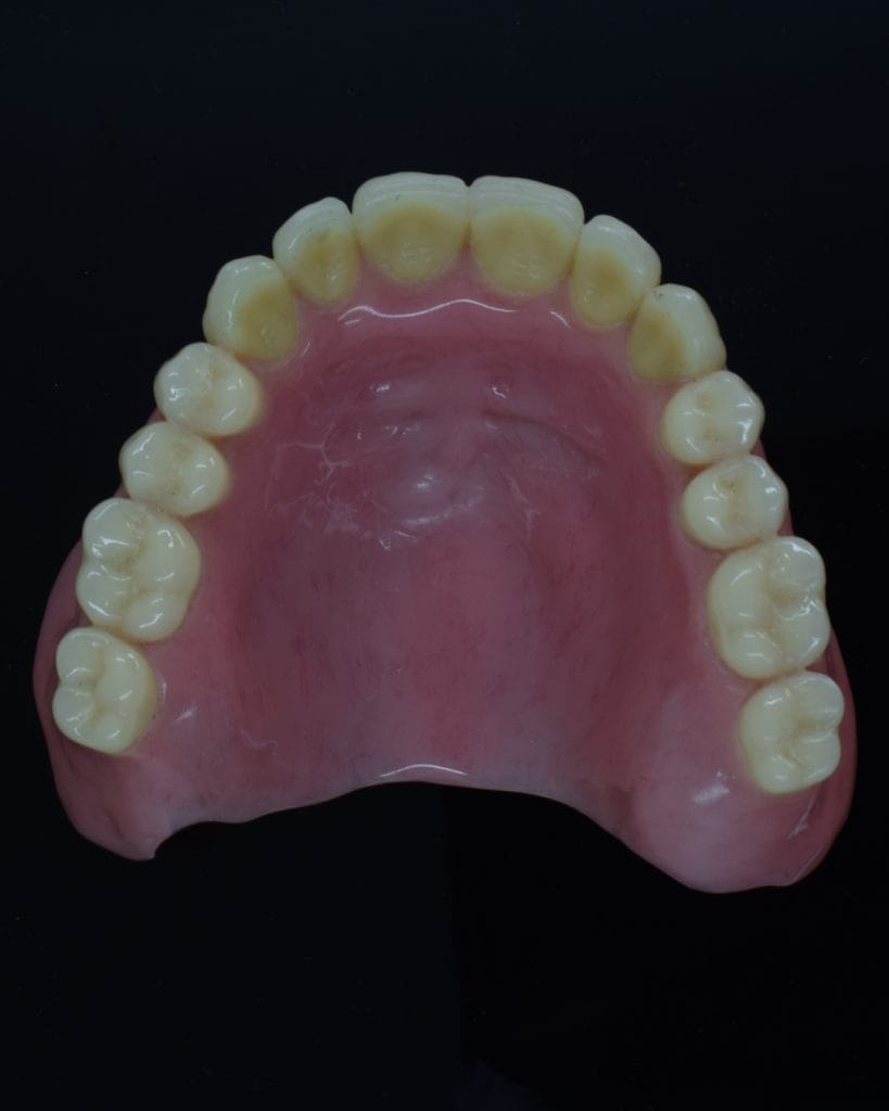 Acrylic Denture