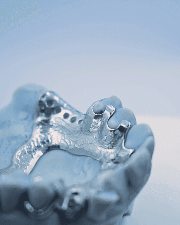 Metal RPD - Denture Kerangka Logam