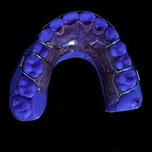 Hawley Retainer