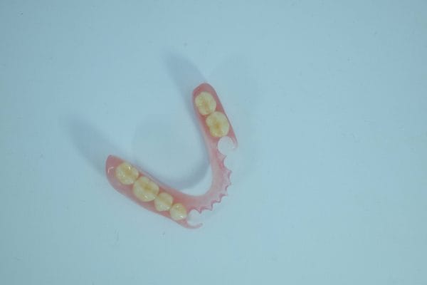 Rigid Thermoplastic Denture