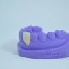 Zirconia Monolithic