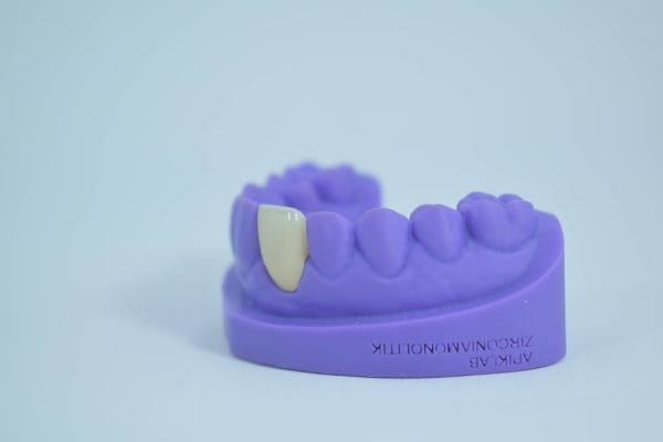 Zirconia Monolithic