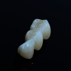 Zirconia Monolithic