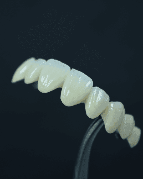apik dental lab indonesia bekasi