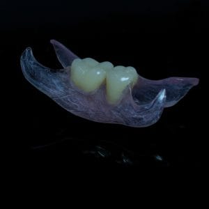 Flexible Nylon Denture