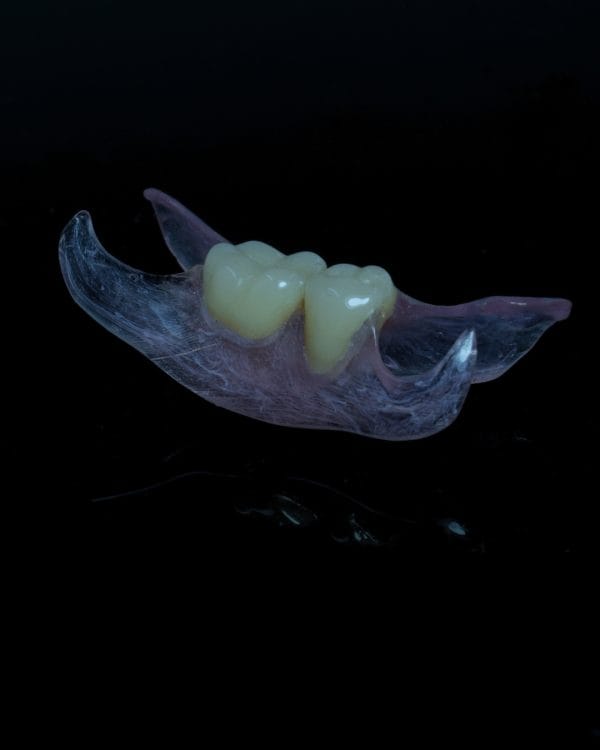 Flexible Nylon Denture